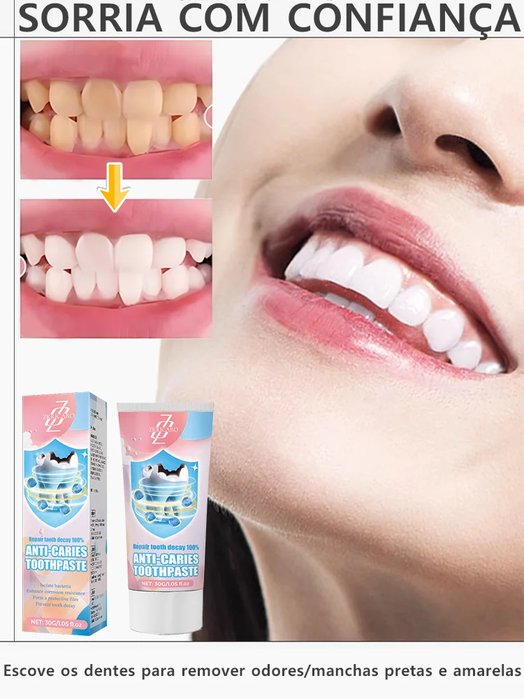 Super Creme Dental Ultra Clareador Removedor de Cáries Reparador Promoção Compre 2 Leve 3