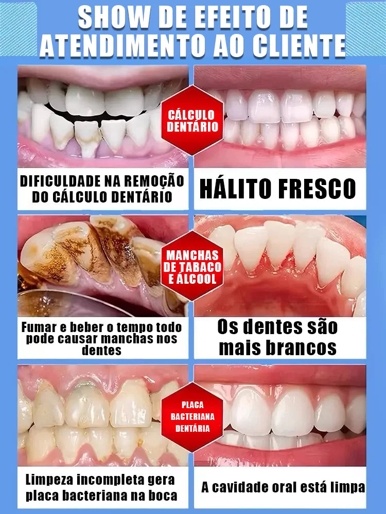 Super Creme Dental Ultra Clareador Removedor de Cáries Reparador Promoção Compre 2 Leve 3