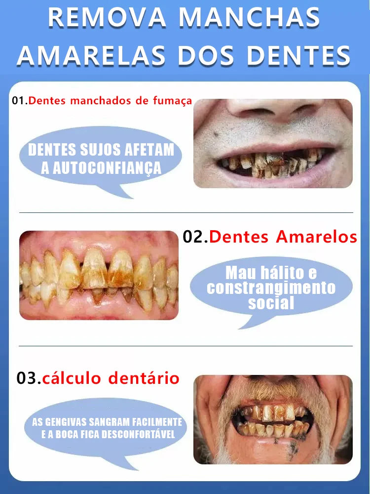 Super Creme Dental Ultra Clareador Removedor de Cáries Reparador Promoção Compre 2 Leve 3